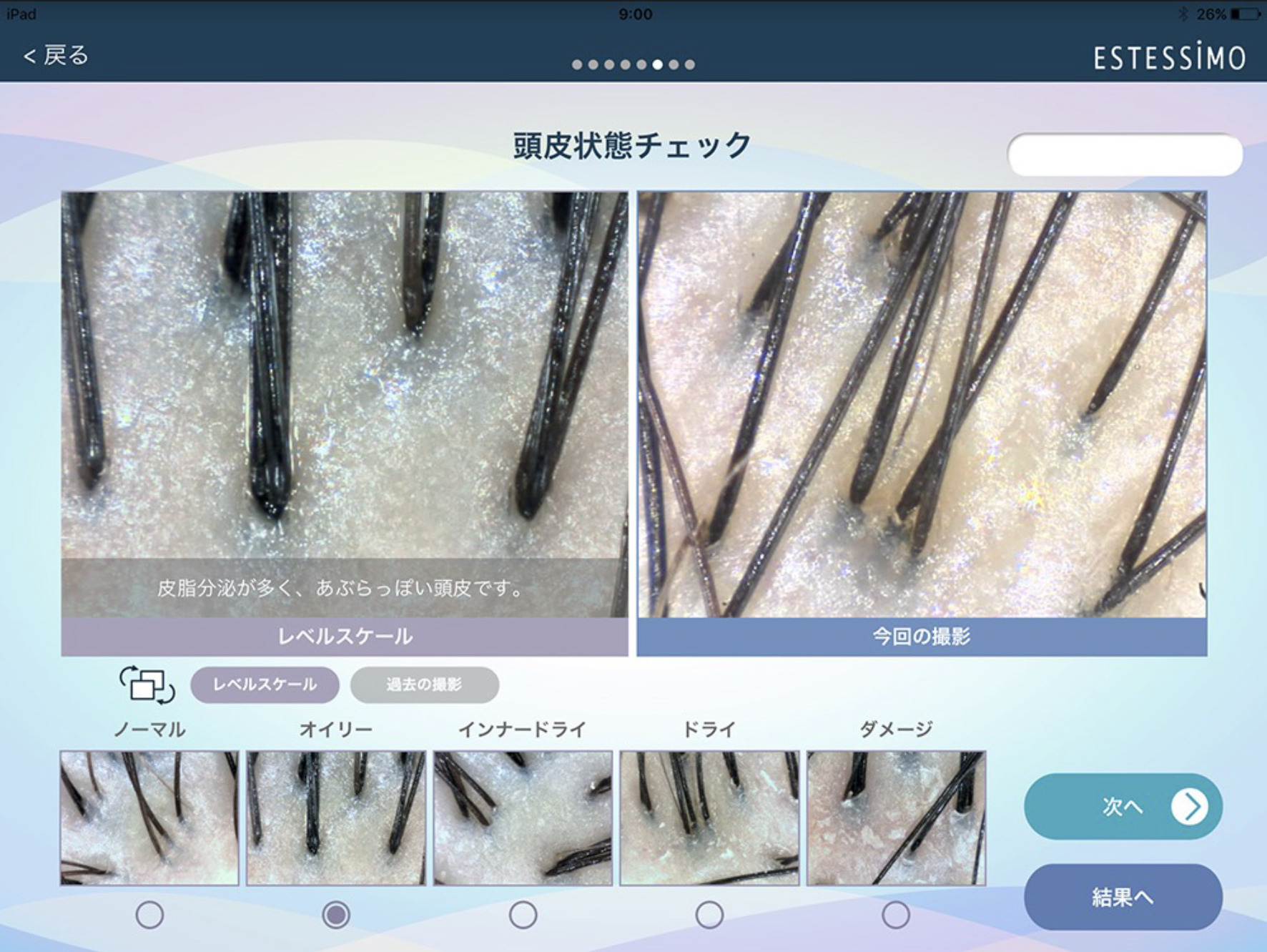 頭皮チェックの様子